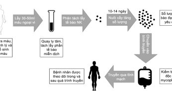 Liệu pháp tế bào miễn dịch Nhật bản